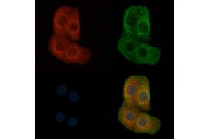 ABIN6257150 and ABIN6274352 staining Hela cells by IF/ICC. (E2F2 抗体  (Internal Region))