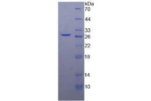 SDS-PAGE analysis of Human DGAT1 Protein. (DGAT1 蛋白)
