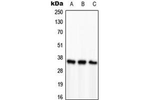 Western blot analysis of PCNA expression in HeLa (A), SP2/0 (B), H9C2 (C) whole cell lysates. (PCNA 抗体  (Center))