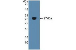 Western blot analysis of recombinant Human ACO1. (Aconitase 1 抗体  (AA 251-443))
