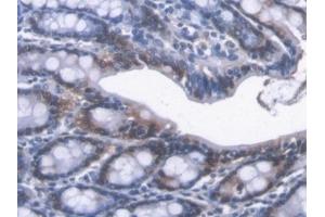 Detection of CBR1 in Mouse Colon Tissue using Polyclonal Antibody to Carbonyl Reductase 1 (CBR1) (CBR1 抗体  (AA 66-271))