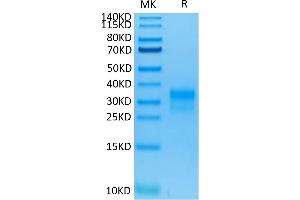 Human Her2/ErbB2 Domain 4 on Tris-Bis PAGE under reduced condition.