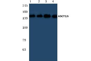 Western blot (WB) analysis of ADCY 5/6 antibody at 1/500 dilution (ADCY5 抗体)