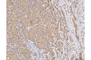 IHC analysis of Calmegin/CLGN using anti-Calmegin/CLGN antibody (ABIN7601481).