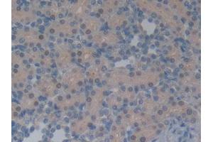 DAB staining on IHC-P; Samples: Rat Kidney Tissue (Neurotensin 抗体  (AA 21-156))