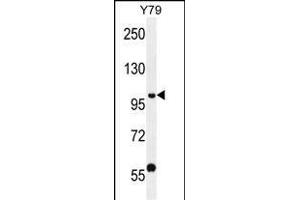 PHF20 Antibody (N-term) (ABIN656095 and ABIN2845438) western blot analysis in Y79 cell line lysates (35 μg/lane). (PHF20 抗体  (N-Term))