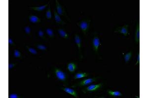Immunofluorescent analysis of Hela cells using ABIN7149863 at dilution of 1:100 and Alexa Fluor 488-congugated AffiniPure Goat Anti-Rabbit IgG(H+L) (SAT1 抗体  (AA 5-171))