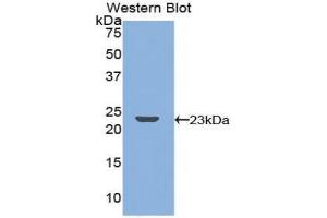 Western blot analysis of the recombinant protein. (TNFRSF11A 抗体  (AA 359-542))