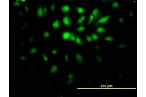 Immunofluorescence of monoclonal antibody to E2F6 on HeLa cell. (E2F6 抗体  (AA 1-281))