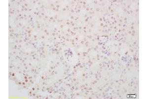 Formalin-fixed and paraffin embedded mouse kidney labeled with Anti-PINX-1 Polyclonal Antibody, Unconjugated (ABIN1387106) at 1:200 followed by conjugation to the secondary antibody and DAB staining (PINX1 抗体  (AA 85-133))