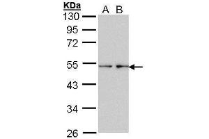 WB Image Sample (30 ug of whole cell lysate) A: HeLa B: Hep G2 , 7. (Fascin 抗体  (Internal Region))