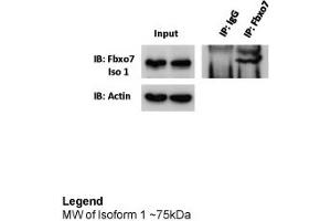 Immunoprecipitation -- 5ug antibody (FBXO7 抗体  (Middle Region))