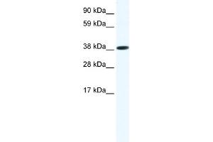 WB Suggested Anti-OBOX6 Antibody Titration:  1. (OBOX6 抗体  (Middle Region))
