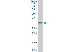 STX4A monoclonal antibody (M04), clone 6D1. (Syntaxin 4 抗体  (AA 19-119))