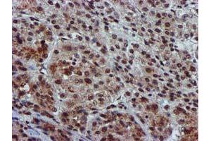 Image no. 14 for anti-Glutathione S-Transferase theta 2 (GSTT2) antibody (ABIN1498553) (GSTT2 抗体)