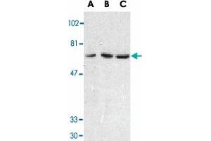 Western blot analysis of TNFRSF10C in HeLa cell (A), mouse (B) and rat (C) liver tissue lysates with TNFRSF10C polyclonal antibody  at 1 ug/mL . (DcR1 抗体  (Extracellular Domain))
