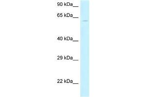 WB Suggested Anti-MON1B Antibody Titration: 1. (MON1B 抗体  (N-Term))