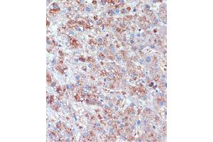 Immunohistochemistry of paraffin-embedded Human liver using TCIRG1 Rabbit pAb (ABIN7270707) at dilution of 1:100 (40x lens). (TCIRG1 抗体  (AA 1-130))