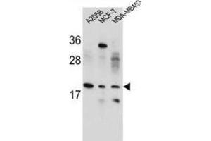 Western Blotting (WB) image for anti-Variable Charge, X-Linked (VCX) antibody (ABIN2995866) (VCX 抗体)
