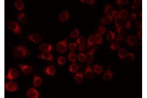 ABIN6276821 staining 293 by IF/ICC. (F12 抗体  (C-Term))