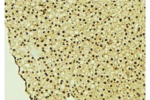 ABIN6277229 at 1/100 staining Mouse liver tissue by IHC-P. (CASK 抗体  (Internal Region))