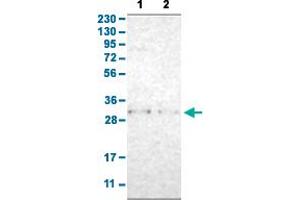 Western Blot analysis with TNFAIP1 polyclonal antibody . (TNFAIP1 抗体  (AA 80-170))