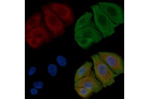 ABIN6262521 and ABIN6269355 staining Hela cells(30 min of UV treatment) by IF/ICC.