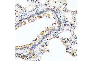 Immunohistochemistry of paraffin-embedded rat lung using CHI3L2 antibody (ABIN5975154) at dilution of 1/100 (40x lens). (CHI3L2 抗体)