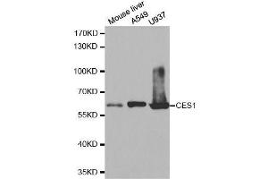 Western blot analysis of extracts of various cell lines, using CES1 antibody. (CES1 抗体  (AA 287-566))