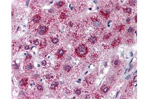 Anti-LDL Receptor antibody IHC of human liver. (LDLR 抗体  (AA 499-511))