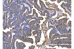 IHC analysis of RALBP1 using anti-RALBP1 antibody (ABIN7600800). (RALBP1 抗体  (AA 239-506))
