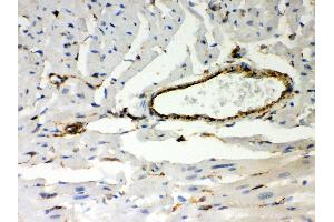 Anti- Vimentin Picoband antibody, IHC(P) IHC(P): Mouse Cardiac Muscle Tissue (Vimentin 抗体  (C-Term))