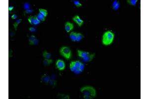 Immunofluorescence staining of MCF-7 cells with ABIN7146522 at 1:200, counter-stained with DAPI. (CAPNL1 抗体  (Catalytic Subunit))