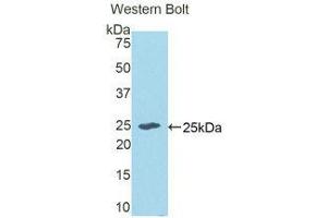 Western Blotting (WB) image for anti-Epithelial Cell Transforming Sequence 2 Oncogene (ECT2) (AA 166-348) antibody (ABIN1175693) (ECT2 抗体  (AA 166-348))
