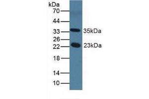 Detection of NOS1AP in Mouse Serum using Polyclonal Antibody to Nitric Oxide Synthase 1 Adaptor Protein (NOS1AP) (NOS1AP 抗体  (AA 19-251))