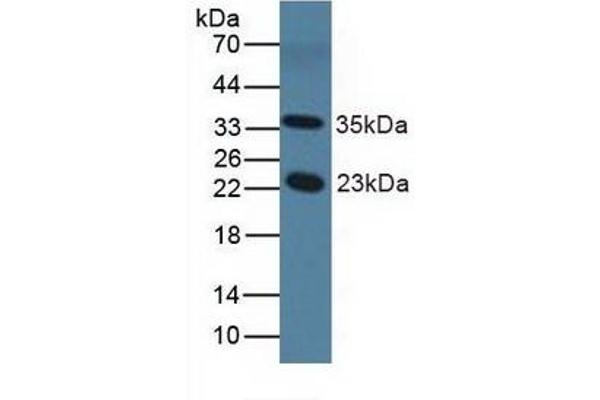 NOS1AP Antikörper  (AA 19-251)