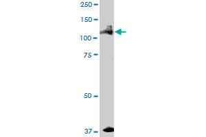 ALPK1 MaxPab polyclonal antibody. (ALPK1 抗体  (AA 1-1085))