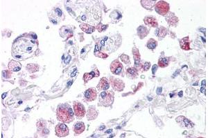 Human Lung: Formalin-Fixed, Paraffin-Embedded (FFPE) (NLRP14 抗体  (N-Term))