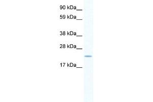 WB Suggested Anti-SERTAD1 Antibody   Titration: 0. (SERTAD1 抗体  (N-Term))
