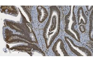 IHC analysis of U2AF65/U2AF2 using anti U2AF65/U2AF2 antibody (ABIN7600794). (U2AF2 抗体  (AA 238-470))