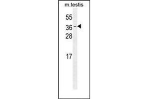 ODF3 抗体  (C-Term)