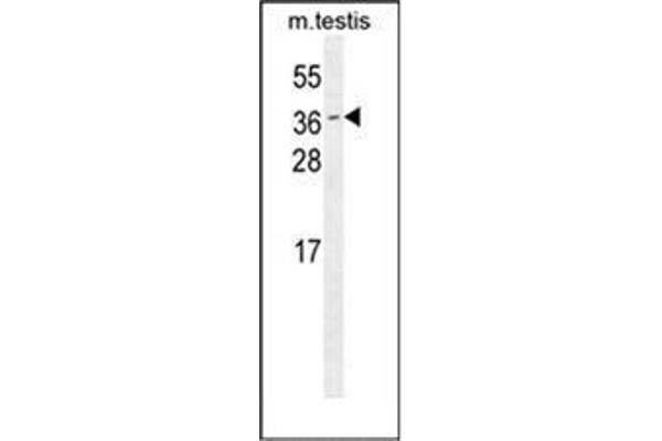 ODF3 抗体  (C-Term)