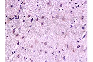Immunohistochemistry (IHC) image for anti-Neurotrophic Tyrosine Kinase, Receptor, Type 2 (NTRK2) (AA 32-120) antibody (ABIN727310)