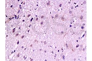 Formalin-fixed and paraffin embedded: rat brain tissue labeled with Anti-TrkB Polyclonal Antibody, Unconjugated (ABIN727310) at 1:200, followed by conjugation to the secondary antibody and DAB staining (TRKB 抗体  (AA 32-120))