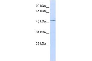 WB Suggested Anti-IL11RA Antibody Titration:  0. (IL11RA 抗体  (N-Term))