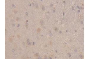 IHC-P analysis of Rat Cerebrum Tissue, with DAB staining. (RBP1 抗体  (AA 2-135))
