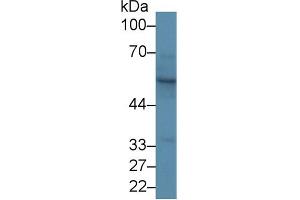 Western Blot; Sample: Rat Skin lysate; Primary Ab: 1µg/ml Rabbit Anti-Rat KRT15 Antibody Second Ab: 0. (KRT15 抗体  (AA 94-402))