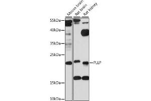 Western blot analysis of extracts of various cell lines, using PLLP antibody (ABIN7269390) at 1:1000 dilution. (Plasmolipin 抗体  (AA 1-100))