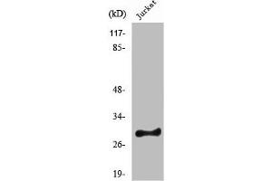 Western Blot analysis of HeLa cells using Rim4 Polyclonal Antibody (RIMS4 抗体  (Internal Region))
