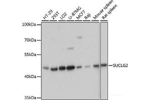 Western blot analysis of extracts of various cell lines using SUCLG2 Polyclonal Antibody at dilution of 1:3000. (SUCLG2 抗体)